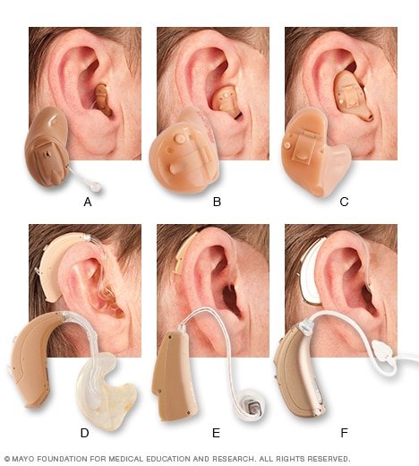 常見助聽器種類,包括 CIC、ITC、ITE、BTE、RIC 及 Open Fit